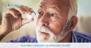 Glaucoma: Bệnh cườm nước và những điều cần biết