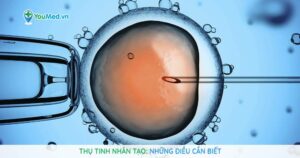 Thụ tinh nhân tạo: Những điều cần biết