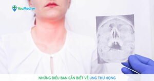 Ung thư họng: nguyên nhân, triệu chứng và cách điều trị