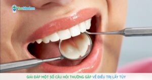 Giải đáp một số câu hỏi thường gặp về điều trị lấy tủy