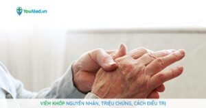 Viêm khớp là gì? Nguyên nhân, triệu chứng, cách điều trị
