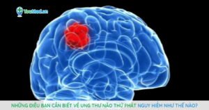 Những điều bạn cần biết về Ung thư não thứ phát nguy hiểm như thế nào?
