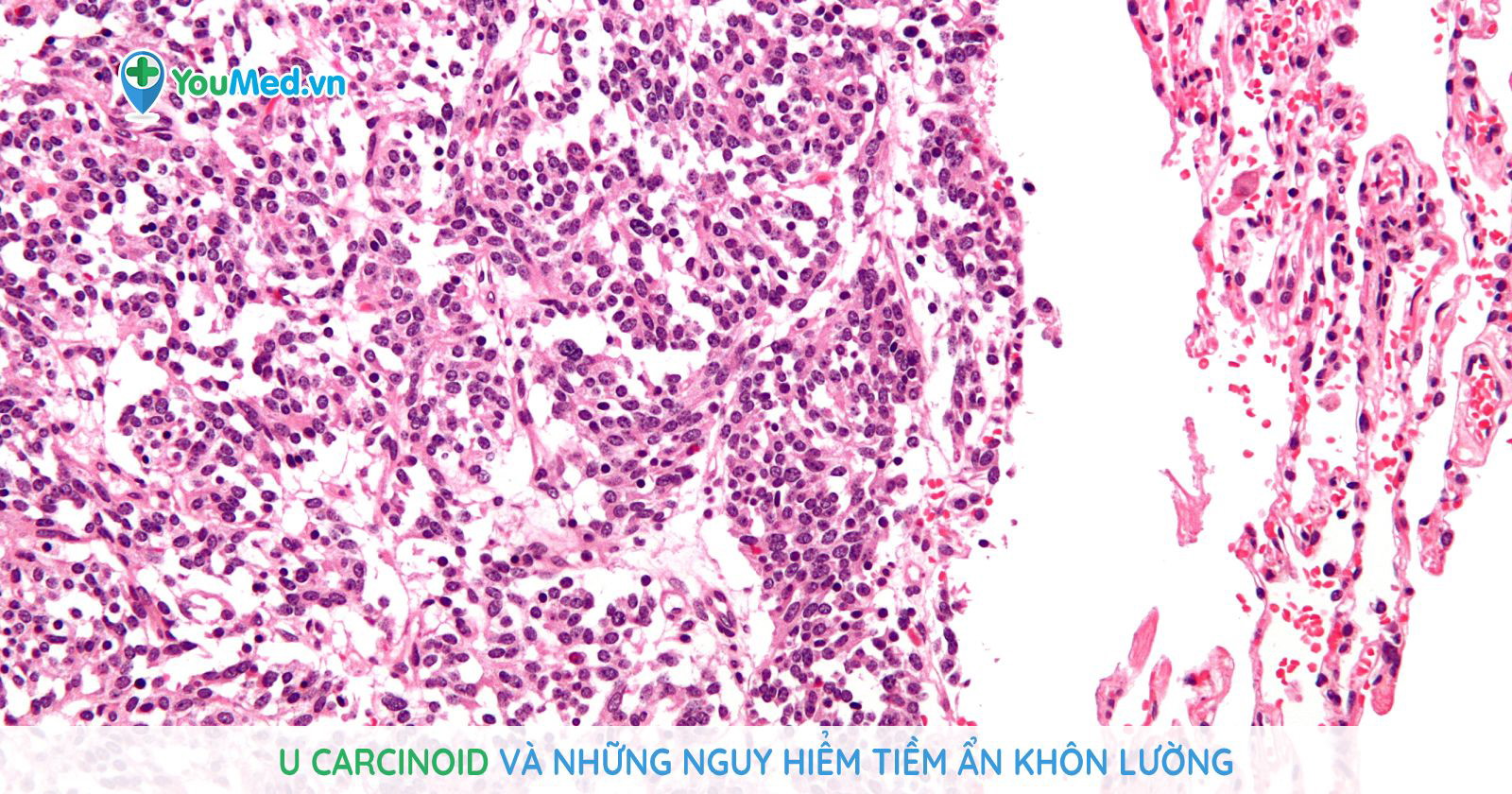 U ormonda mushukini korsatdi U ormonda mushukini korsatdi