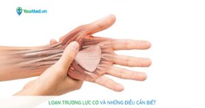 Loạn trương lực cơ và những điều cần biết