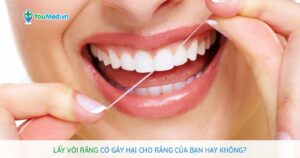 Lấy vôi răng có gây hại cho răng của bạn hay không?