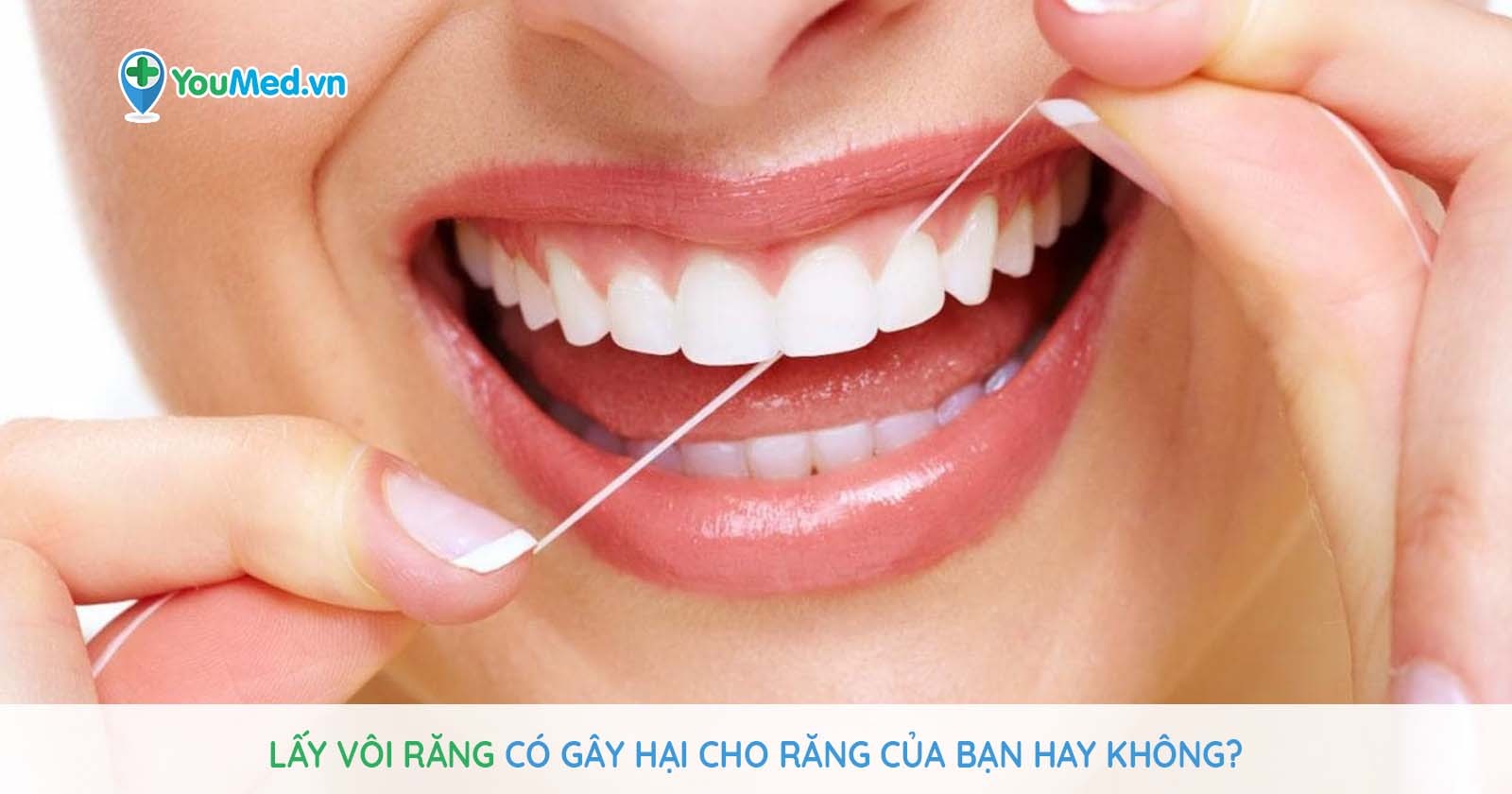 Lấy vôi răng có gây hại cho răng của bạn hay không?