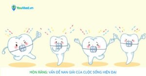 Mòn răng: Vấn đề nan giải của cuộc sống hiện đại