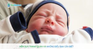 Mềm sụn thanh quản và những điều bạn cần biết