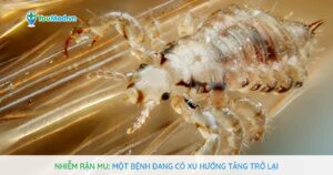 Nhiễm rận mu: Một bệnh đang có xu hướng tăng trở lại