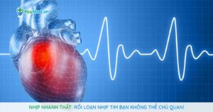 Nhịp nhanh thất: Rối loạn nhịp tim bạn không thể chủ quan!