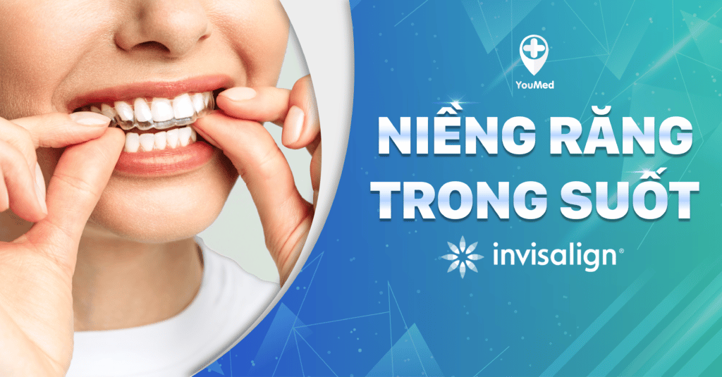 Niềng răng trong suốt - ivisualign