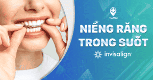 Niềng răng trong suốt và những thông tin bạn cần biết