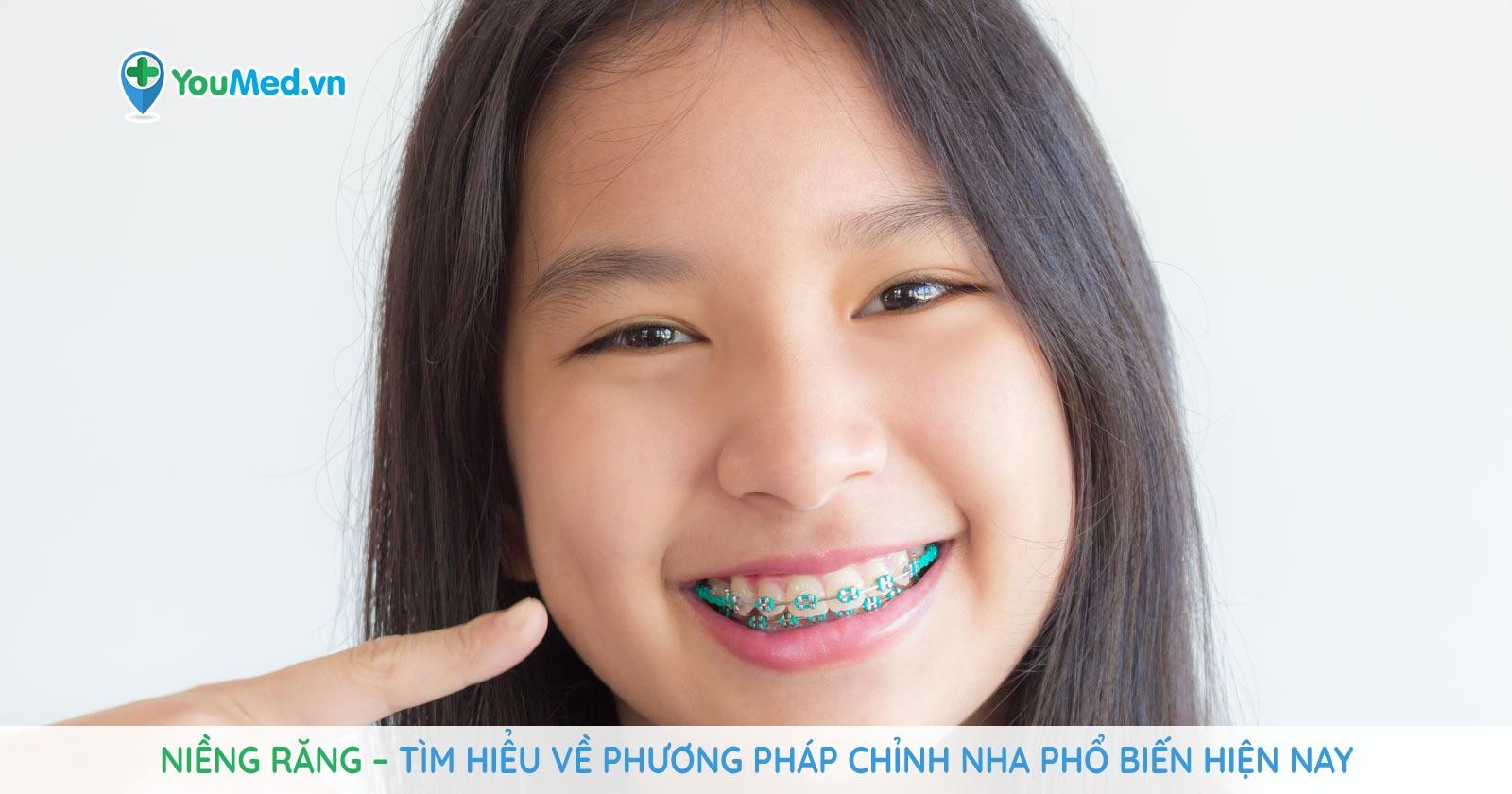 Niềng răng – Tìm hiểu về phương pháp chỉnh nha phổ biến hiện nay