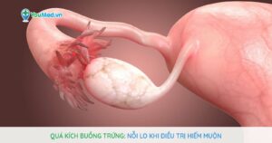 Quá kích buồng trứng: Nỗi lo khi điều trị hiếm muộn