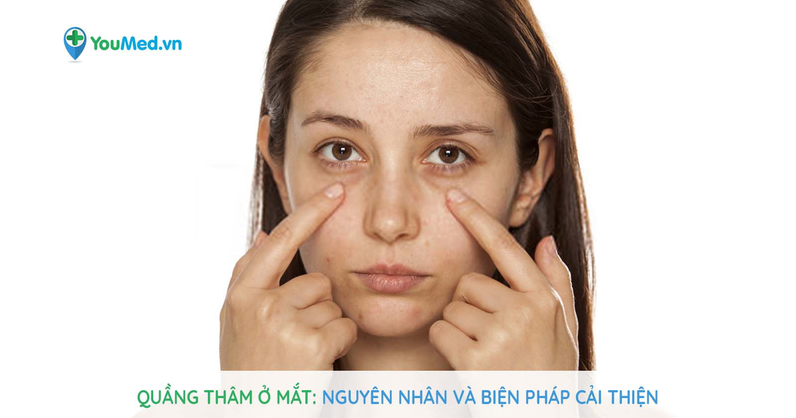 Quầng thâm ở mắt: Làm sao để cải thiện? - YouMed