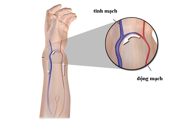 Tĩnh Mạch Ở Cổ Tay: Nguyên Nhân, Triệu Chứng Và Phương Pháp Điều Trị Hiệu Quả