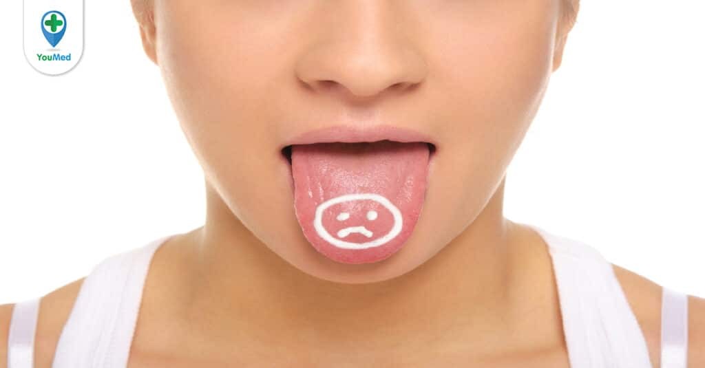 Tê lưỡi và những bệnh lý liên quan