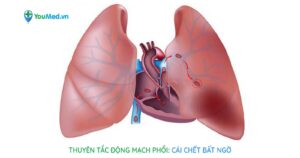 Thuyên tắc động mạch phổi: Cái chết bất ngờ