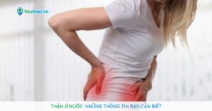 Thận ứ nước: nguyên nhân, triệu chứng và điều trị