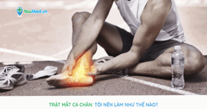 Trật mắt cá chân (lật sơ mi): Tôi nên làm như thế nào?
