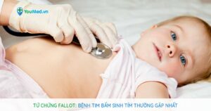 Tứ chứng Fallot: Bệnh tim bẩm sinh tím thường gặp nhất