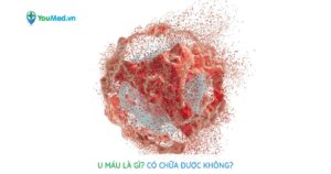 U máu ở trẻ: Những điều phụ huynh cần biết