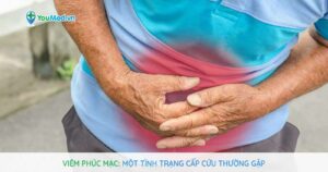 Viêm phúc mạc: Một tình trạng cấp cứu thường gặp