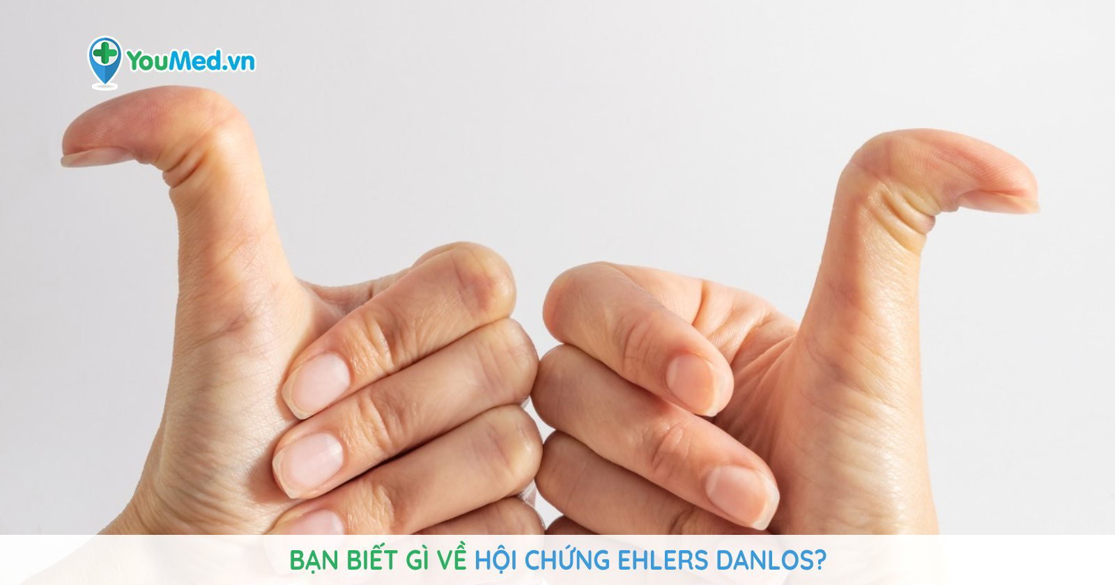 Tìm hiểu về hội chứng ehlers-danlos và những thông tin quan trọng