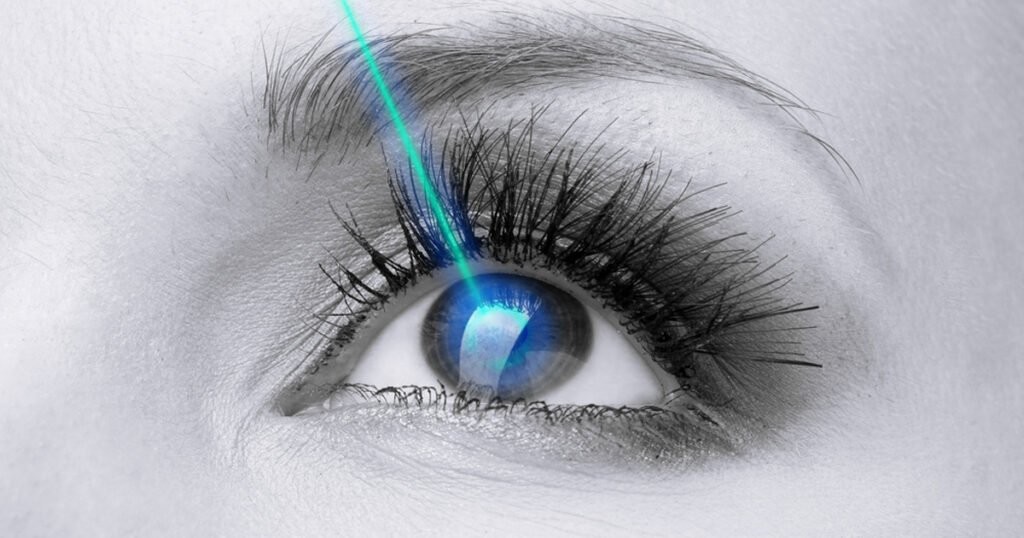 SmartSurfACE, phương pháp này được mệnh danh là “phẫu thuật mắt mà không cần chạm vào mắt”