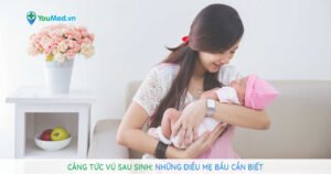 Căng tức vú sau sinh: Những điều mẹ bầu cần biết