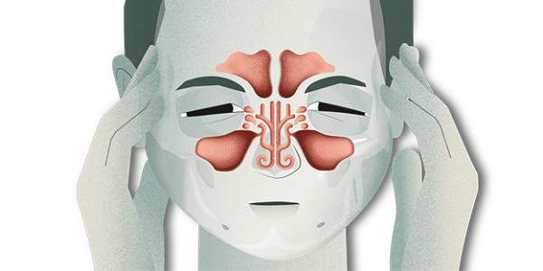 Một số triệu chứng của đau đầu do xoang