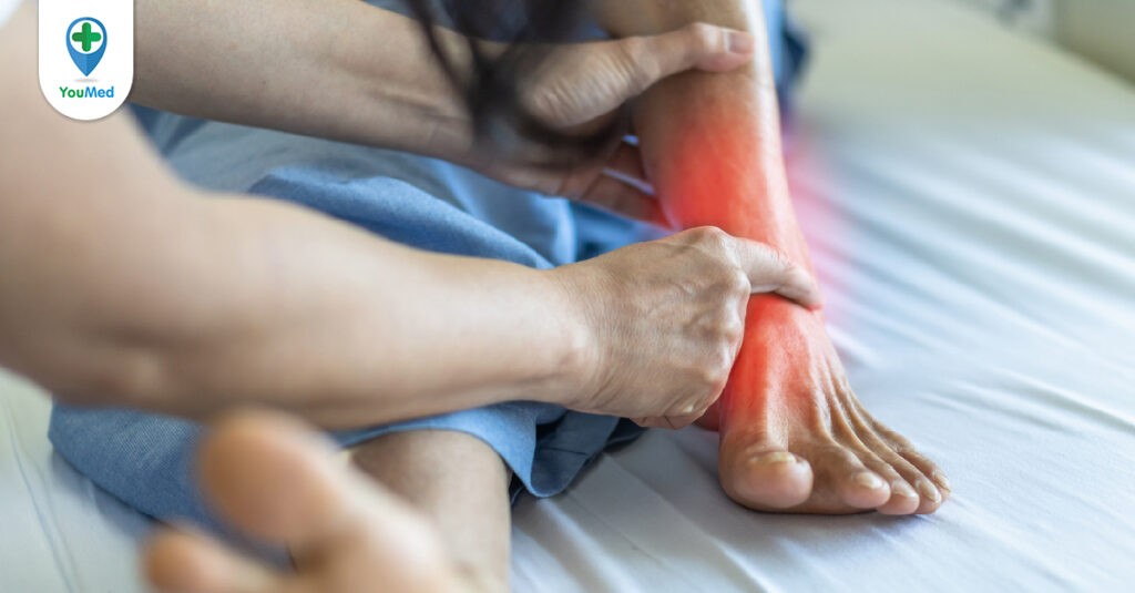 Gãy xương cổ chân: triệu chứng, chẩn đoán và cách điều trị