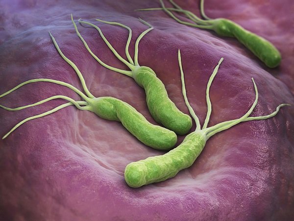 Nhiễm H.Pylori ít gây triệu chứng nhưng hoàn toàn không thể xem thường