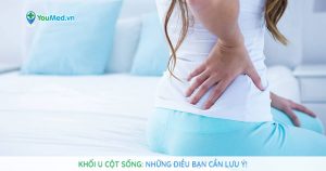 Khối u cột sống: Những điều bạn cần lưu ý