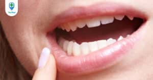 Những điều bạn cần biết khi bị loét áp tơ