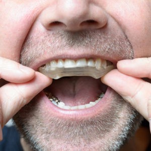nghiến răng