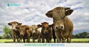 Những điều chưa biết về bệnh bò điên
