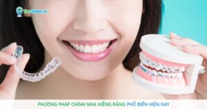 5 phương pháp chỉnh nha niềng răng phổ biến hiện nay