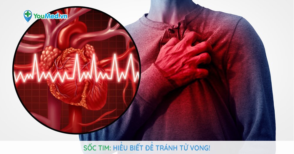 Sốc tim: Nguyên nhân gây tử vong nhanh chóng!