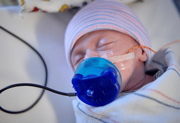 Một số vấn đề hô hấp khiến trẻ sinh non cần được hỗ trợ hô hấp