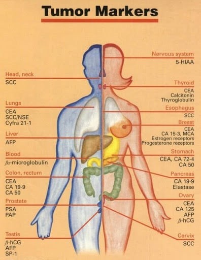 tumor markers
