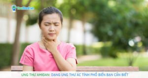 Ung thư amiđan: Dạng ung thư ác tính phổ biến cần biết!