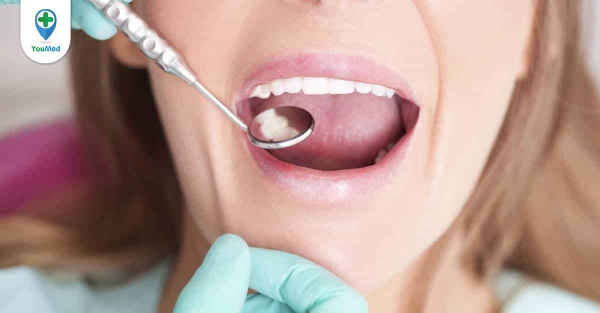 Điều gì gây ra viêm ổ răng khô?
