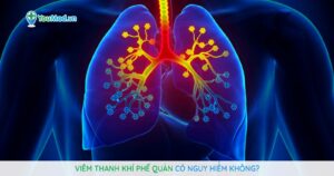 Viêm thanh khí phế quản có nguy hiểm không?