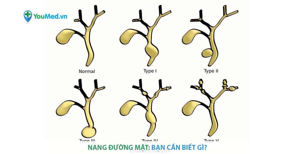 Nang đường mật: Bạn cần biết gì?