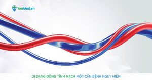 Dị dạng động tĩnh mạch: Một căn bệnh nguy hiểm!