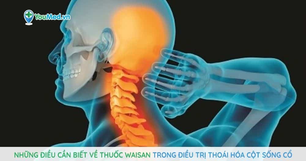 Những điều cần biết về thuốc Waisan trong điều trị thoái hóa cột sống cổ