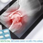Thuốc NextG Cal Bổ sung canxi và điều trị loãng xương