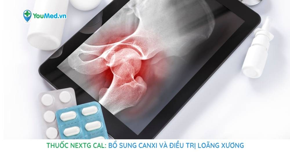 Thuốc NextG Cal: Bổ sung canxi và điều trị loãng xương
