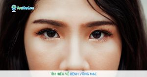 Tìm hiểu về bệnh võng mạc